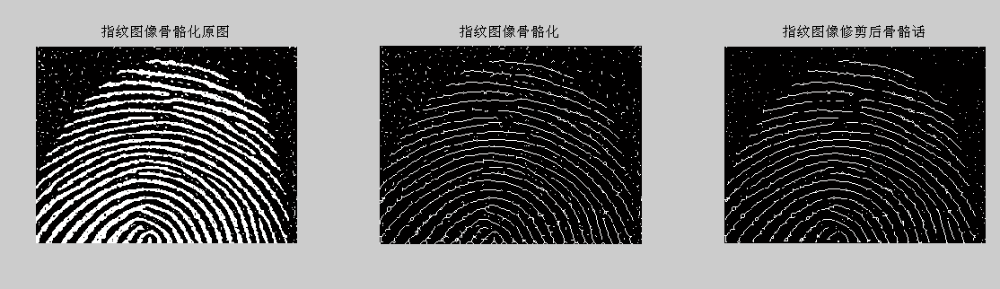 数据分析和图像处理_中值滤波处理图像_图像前期处理